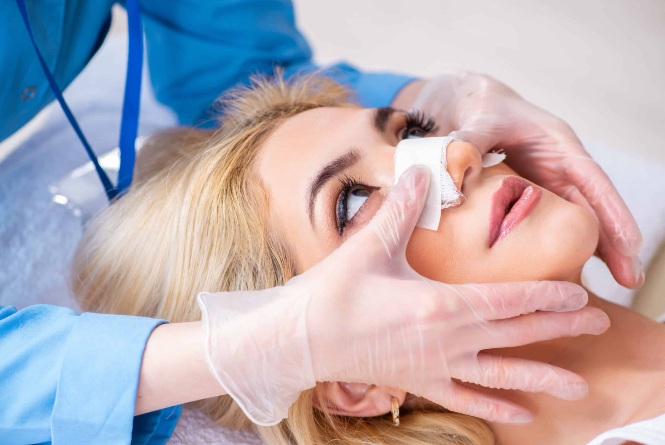 Rinoplastia