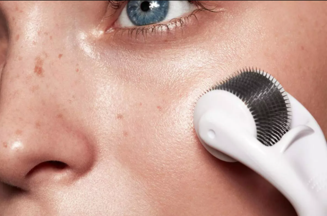 Microneedling